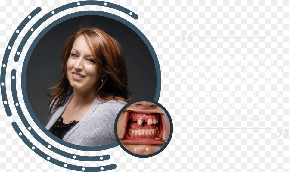 0 Patient Portrait Pau Girl, Adult, Body Part, Female, Mouth Free Png Download