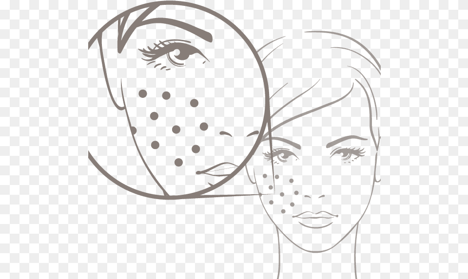 Acne, Art, Face, Head, Person Png