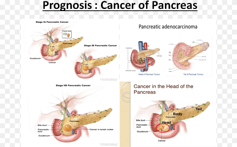 Pancreas Png