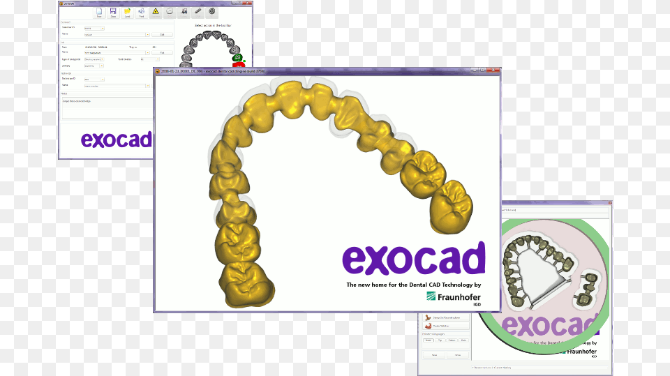 29 August 2010 Exocad, Accessories, Bead Free Png Download