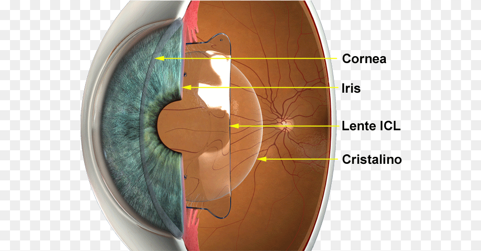 Lente De Camara, Ct Scan Free Transparent Png