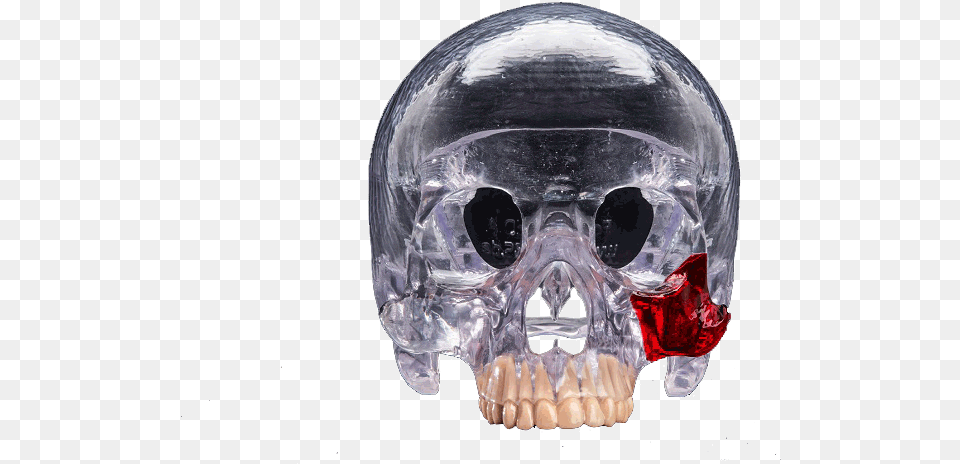 3d Printed Head Skull Surgical Guide 3d Printing, Body Part, Mouth, Person, Teeth Free Png Download