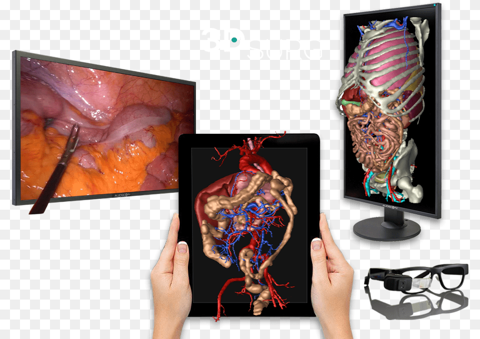3d Technology Applied To Surgery Graphic Design, Ct Scan, Architecture, Building, Hospital Free Png Download