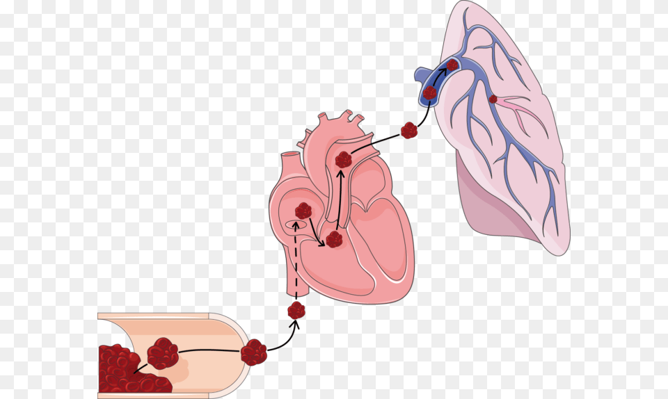 Lungs, Berry, Food, Fruit, Plant Png Image