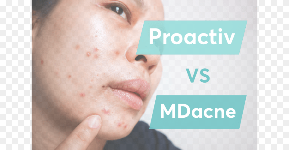 A Comparison Between Mdacne Proactivmd And Proactiv Close Up, Face, Head, Person, Skin Png Image
