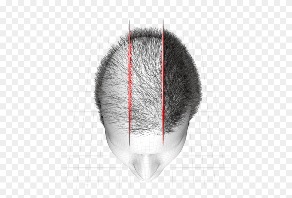 A Fase 3 Do Hairloss Blocker Funciona A Mitos E Verdades Sobre Cabelos, Sphere, Plot, Person, Neck Free Png Download