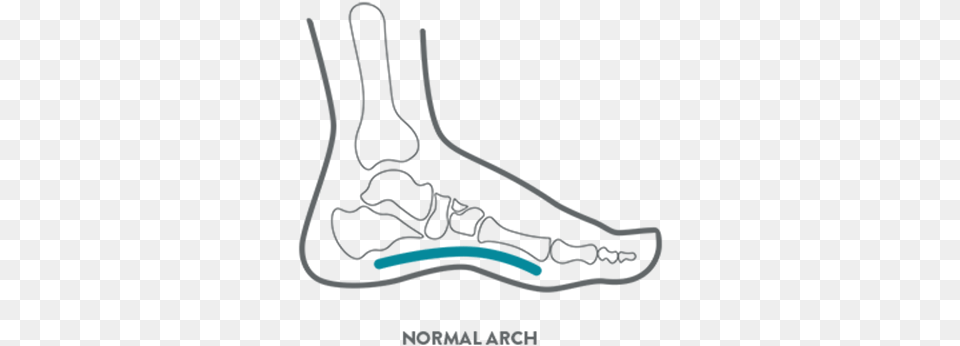 A Kids Foot Health Diagram Illustrating A Normal Arch Illustration, Ct Scan, Smoke Pipe Free Png Download