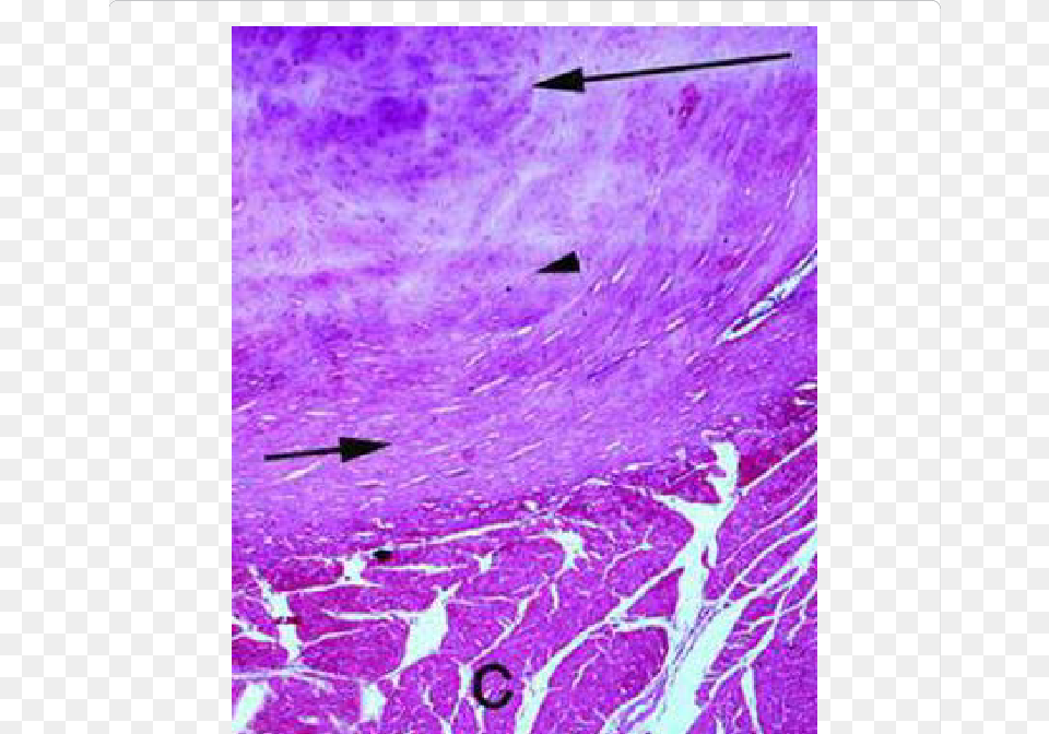 A Photomicrograph Showing The Hyaline Cartilage Fibrous Hyaline Ct, Purple, Paper, Towel Free Png