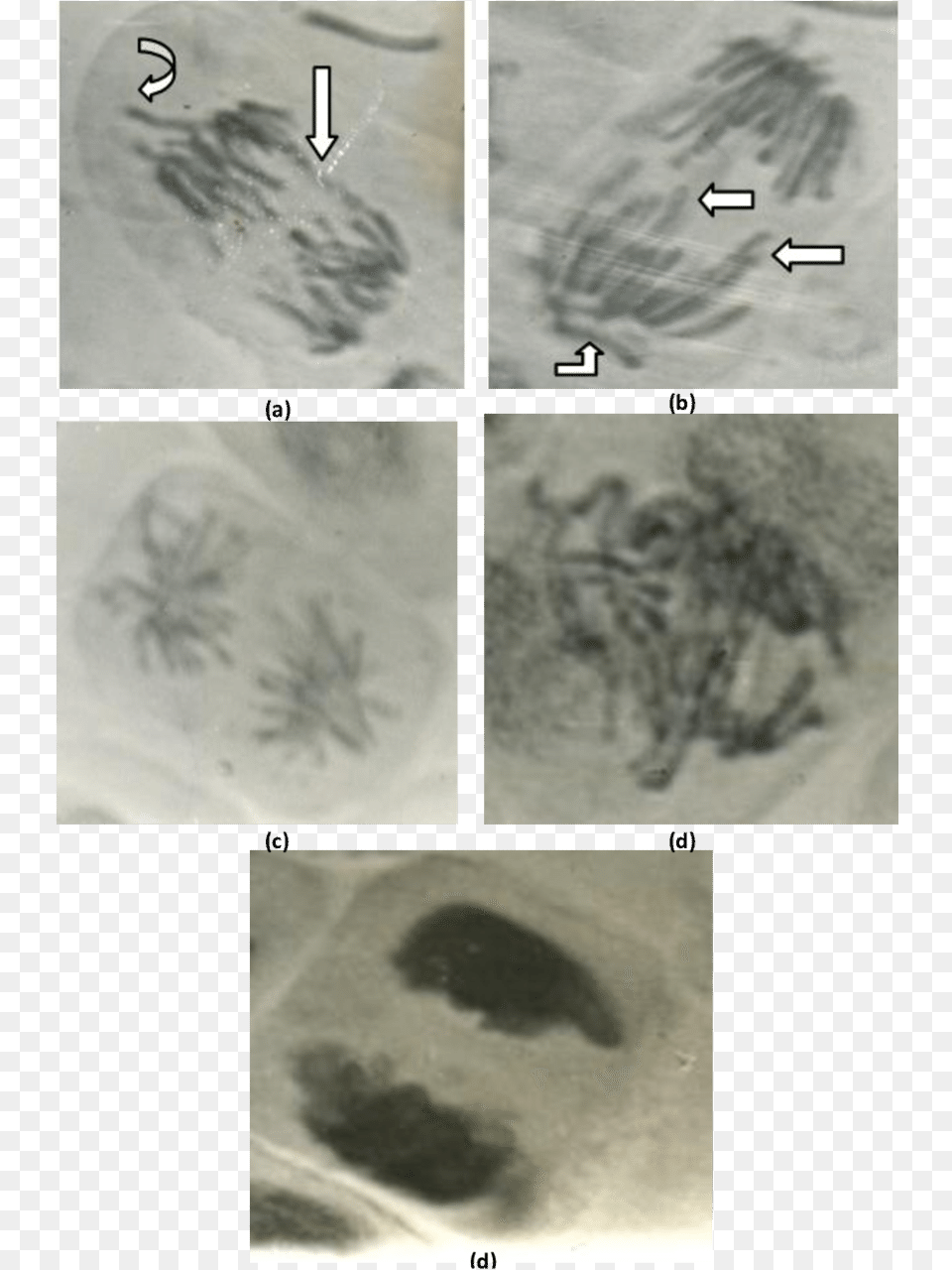 Abnormal Anaphase Cells Showing Chromosome, Adult, Bride, Female, Person Png