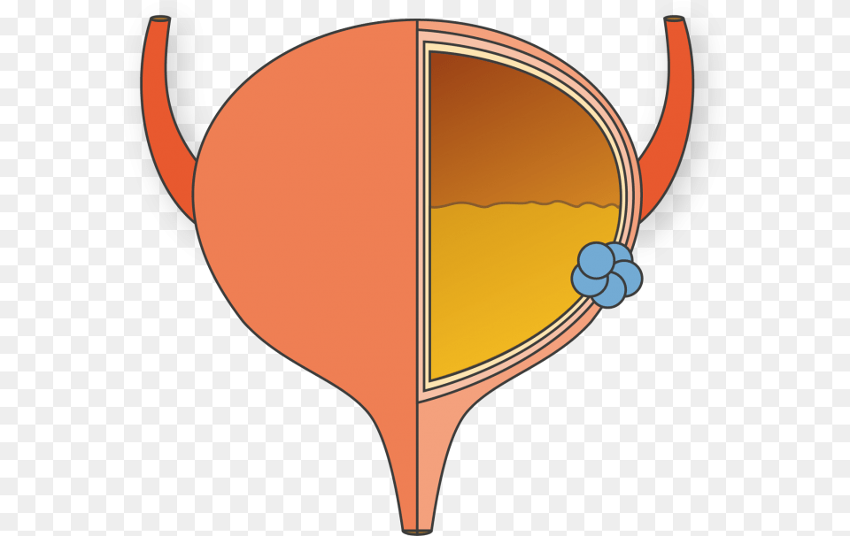 About Bladder Cancer Bladder Cancer Transparent, Racket, Balloon Free Png Download