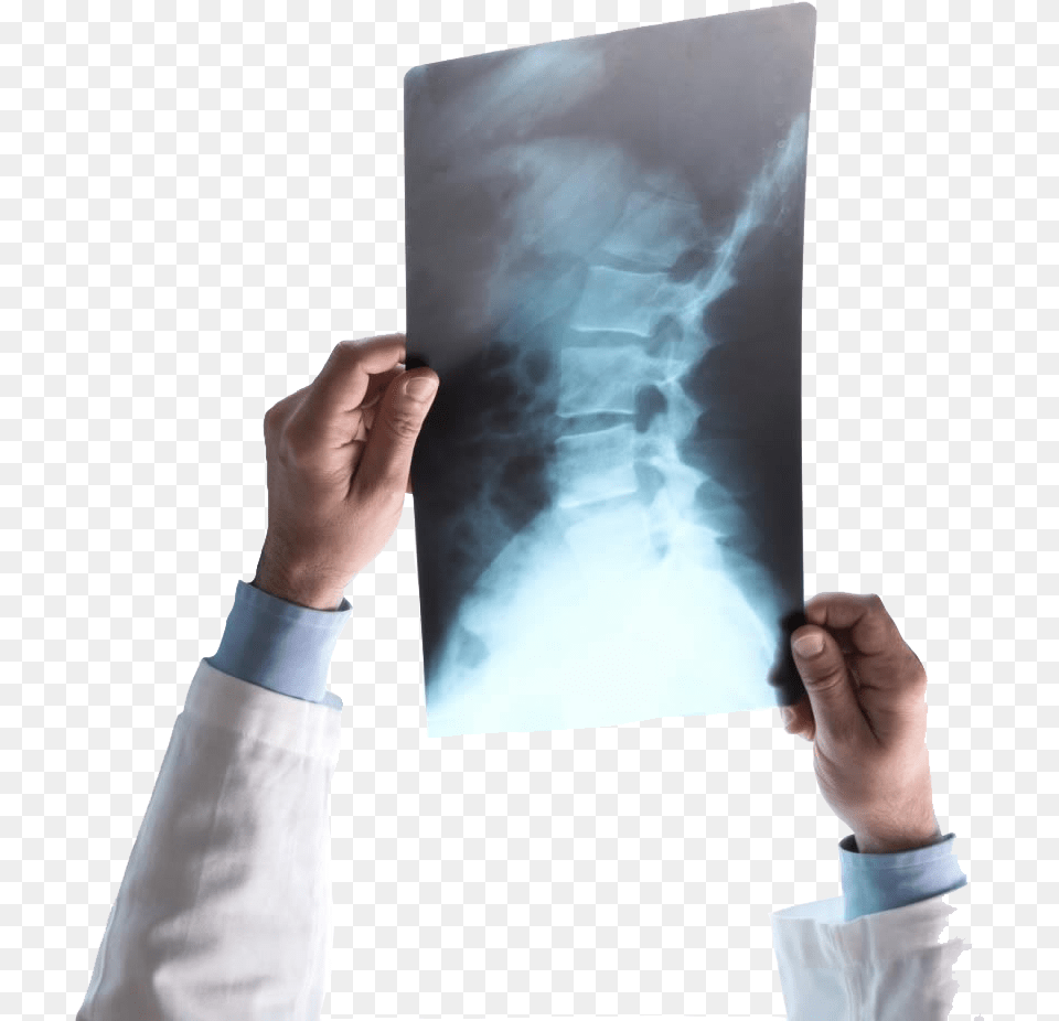 About Southwest X Ray Alat Rontgen Tulang Belakang, X-ray, Art, Painting, Adult Png Image