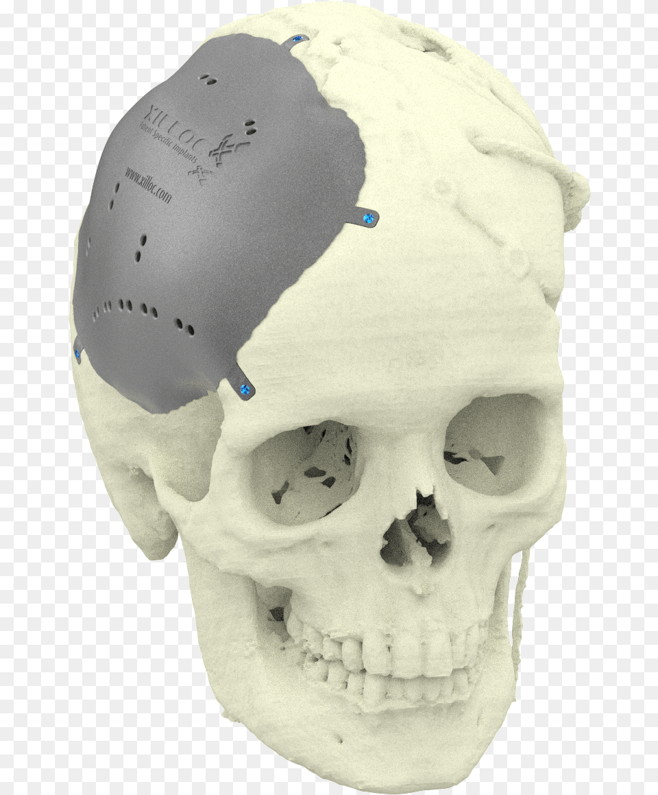 About Us Xilloc 3d Skull, Baby, Person, Head, Face Free Png