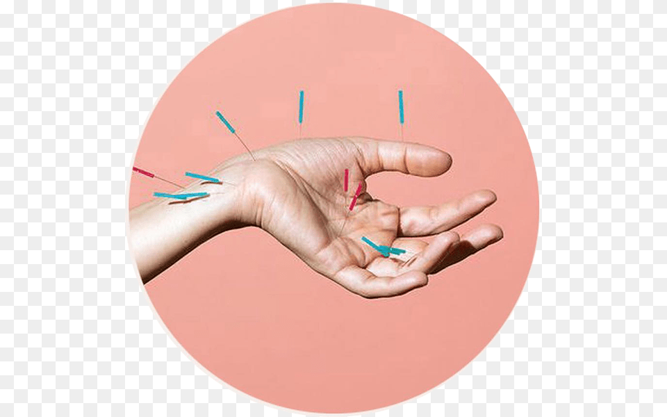 Acupunture Akupunktur Can Actr M, Body Part, Finger, Hand, Person Png