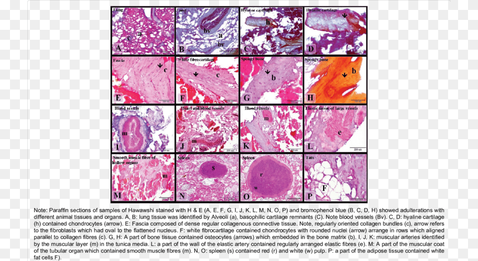 Adulterations Of Hawawshi Samples With Animal Tissues Animal Tissues, Purple, Art, Collage Png Image