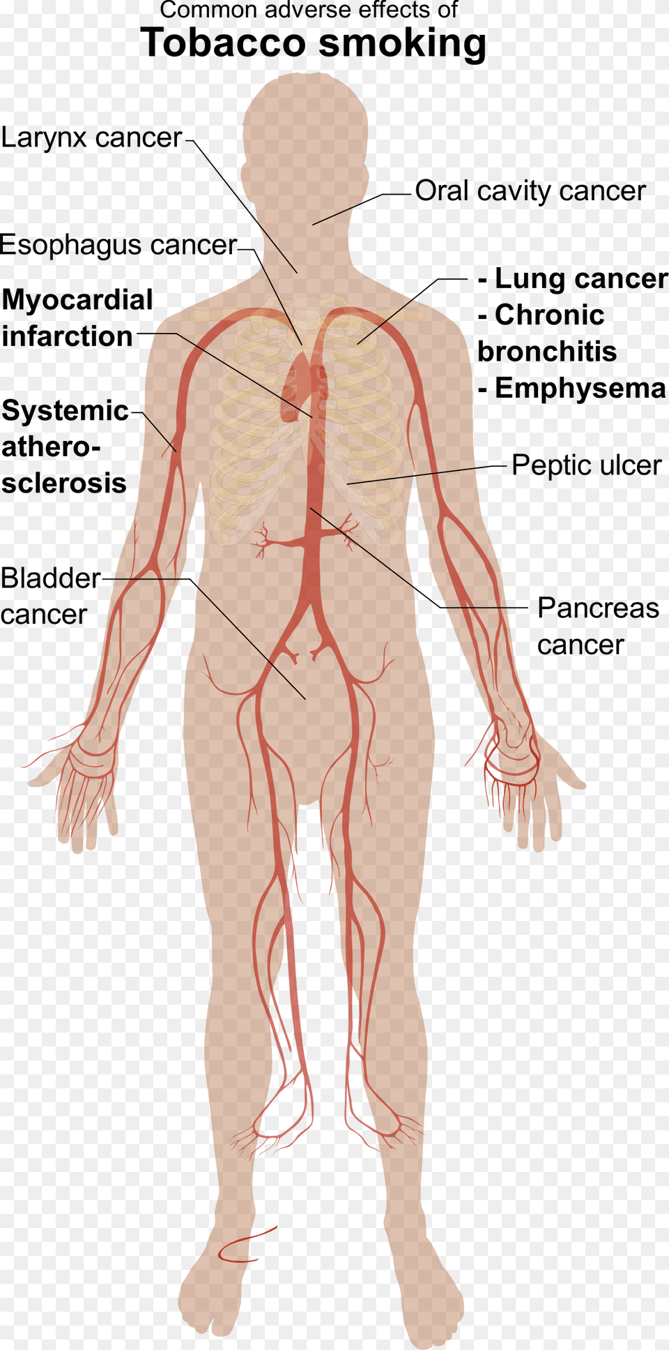 Adverse Effects Of Tobacco Smoking Clip Arts Tobacco A Silent Killer, Adult, Male, Man, Person Free Transparent Png