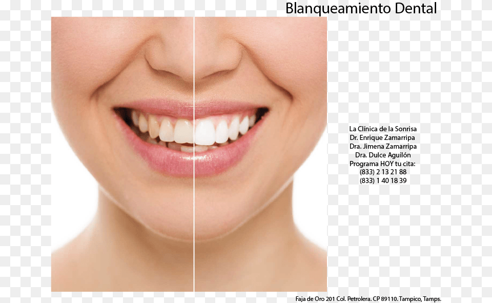Aesthetic Teeth Restoration, Body Part, Mouth, Person, Face Png