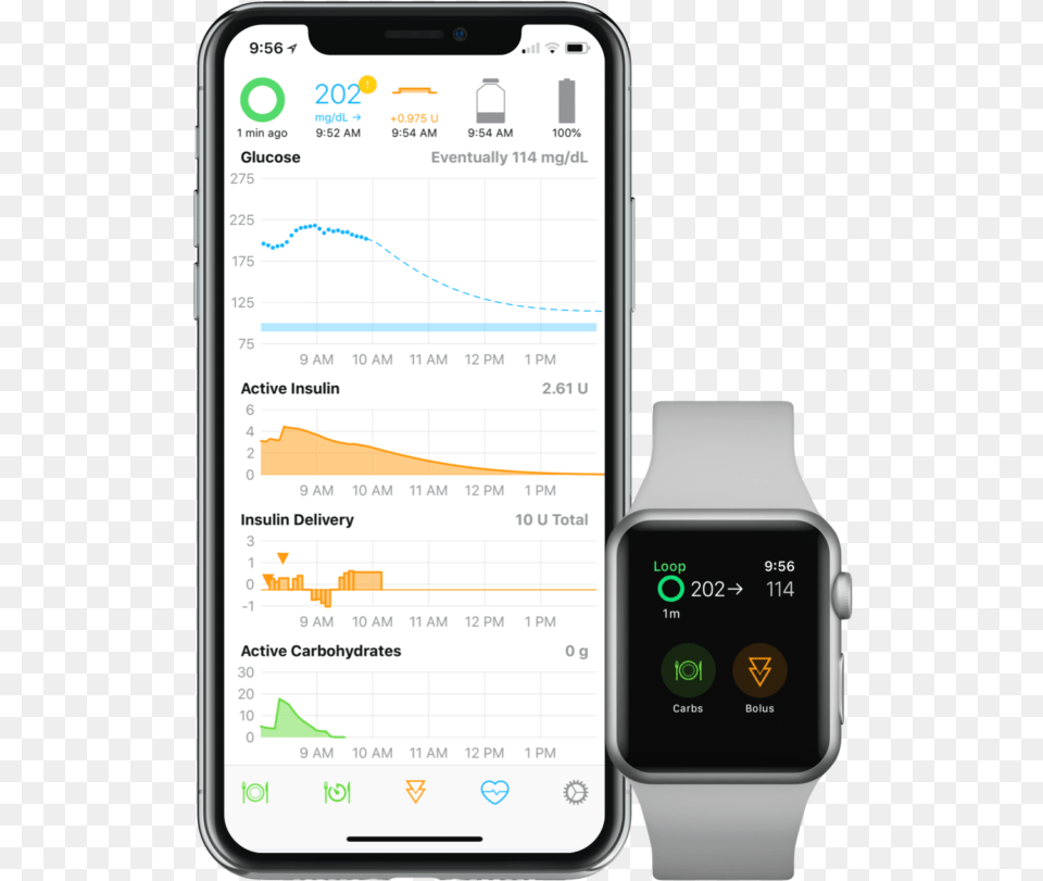 Afib On Apple Watch, Electronics, Mobile Phone, Phone, Wristwatch Free Png