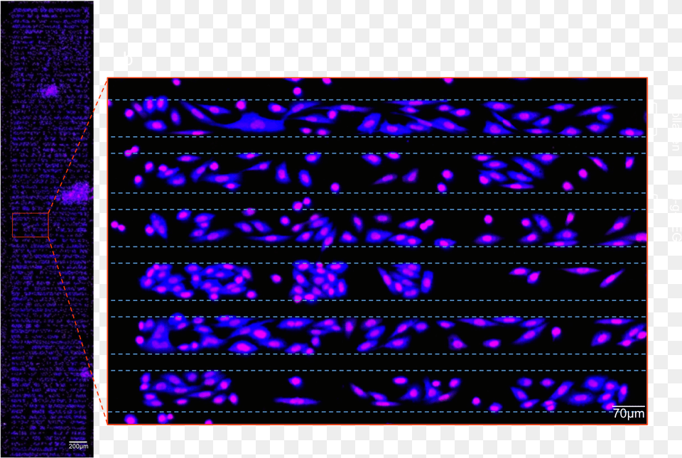 After Fluorescence Staining Cells Are Detected With, Purple, Ct Scan, Computer Hardware, Electronics Free Png Download