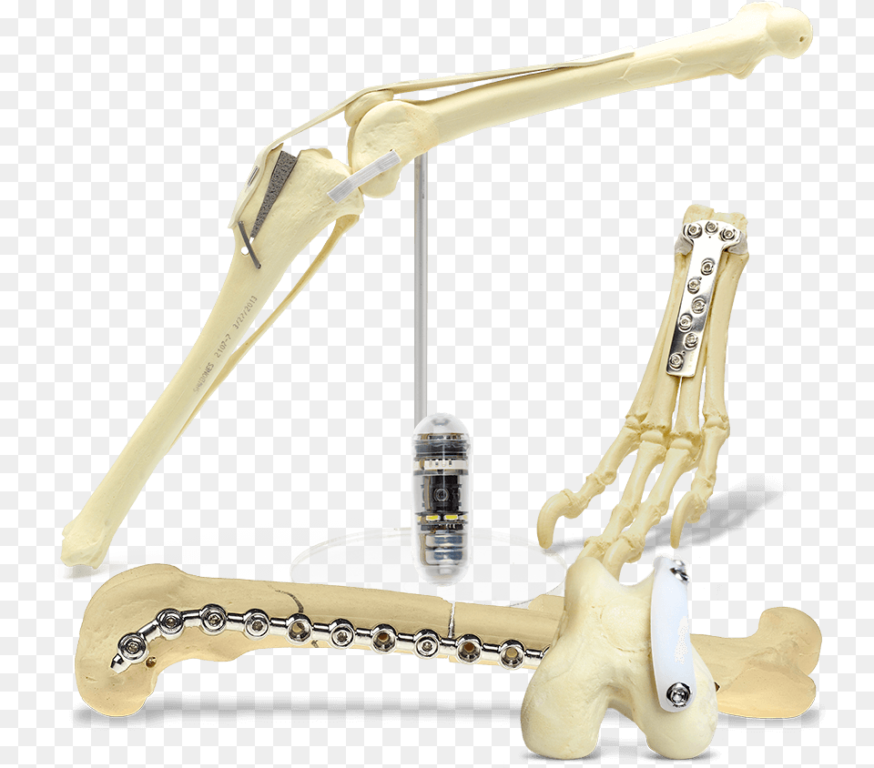 All Categories Mmo Sop Ridgestop Carpal Arthrodesis Figurine, Smoke Pipe, Electronics, Hardware Free Png