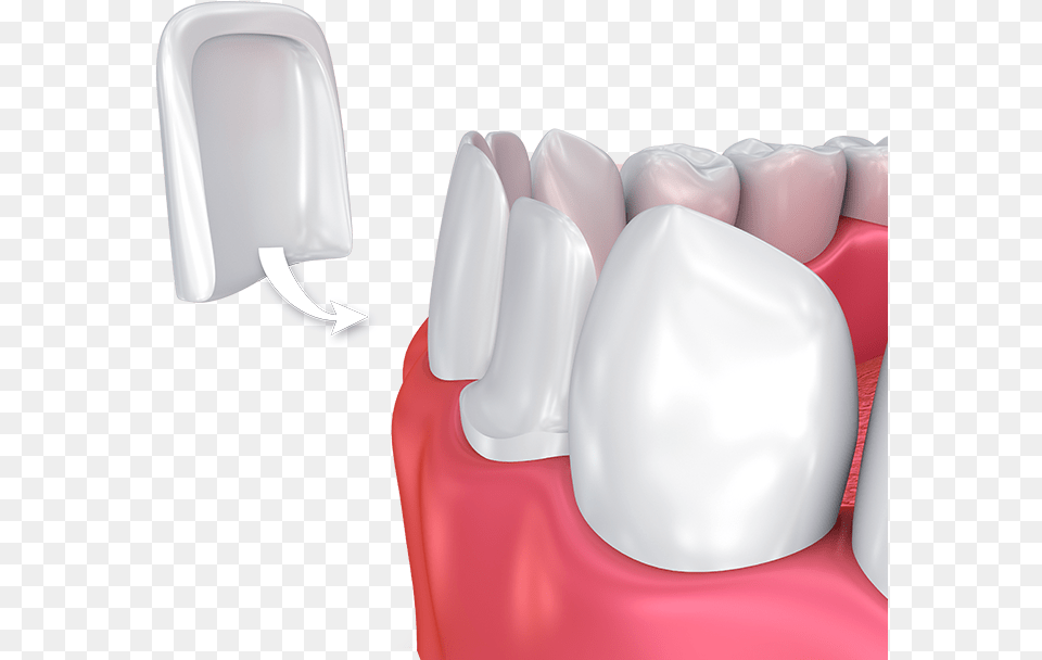 All Tooth Veneers, Body Part, Cushion, Home Decor, Mouth Free Png