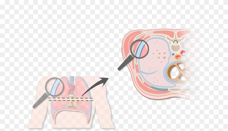 An Expanded View Of The Thorax Magnifying The Pleura Two Transparent Pleural Membranes, Head, Person, Face Free Png
