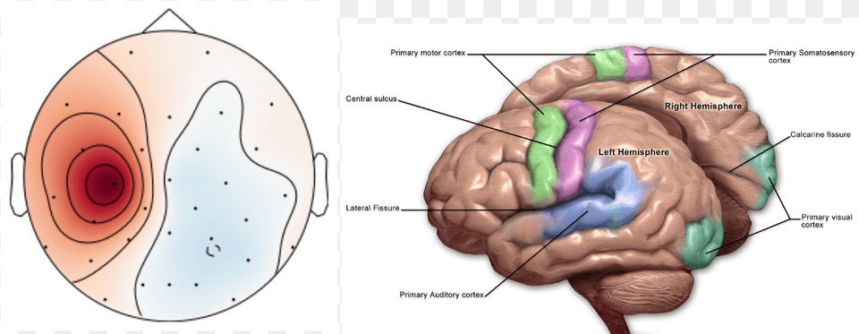 Analysis Of Eeg Readings Showing Where The Subject39s Dyspraxia In The Brain, Animal, Food, Invertebrate, Lobster Png Image