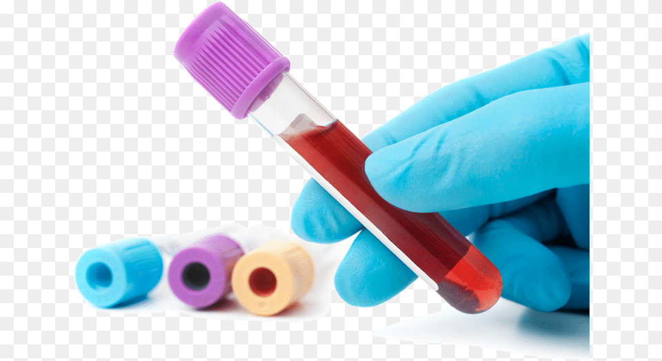 Anlisis De Sangre Osce Stations For Medical Finals Book, Test Tube, Tape Free Png Download