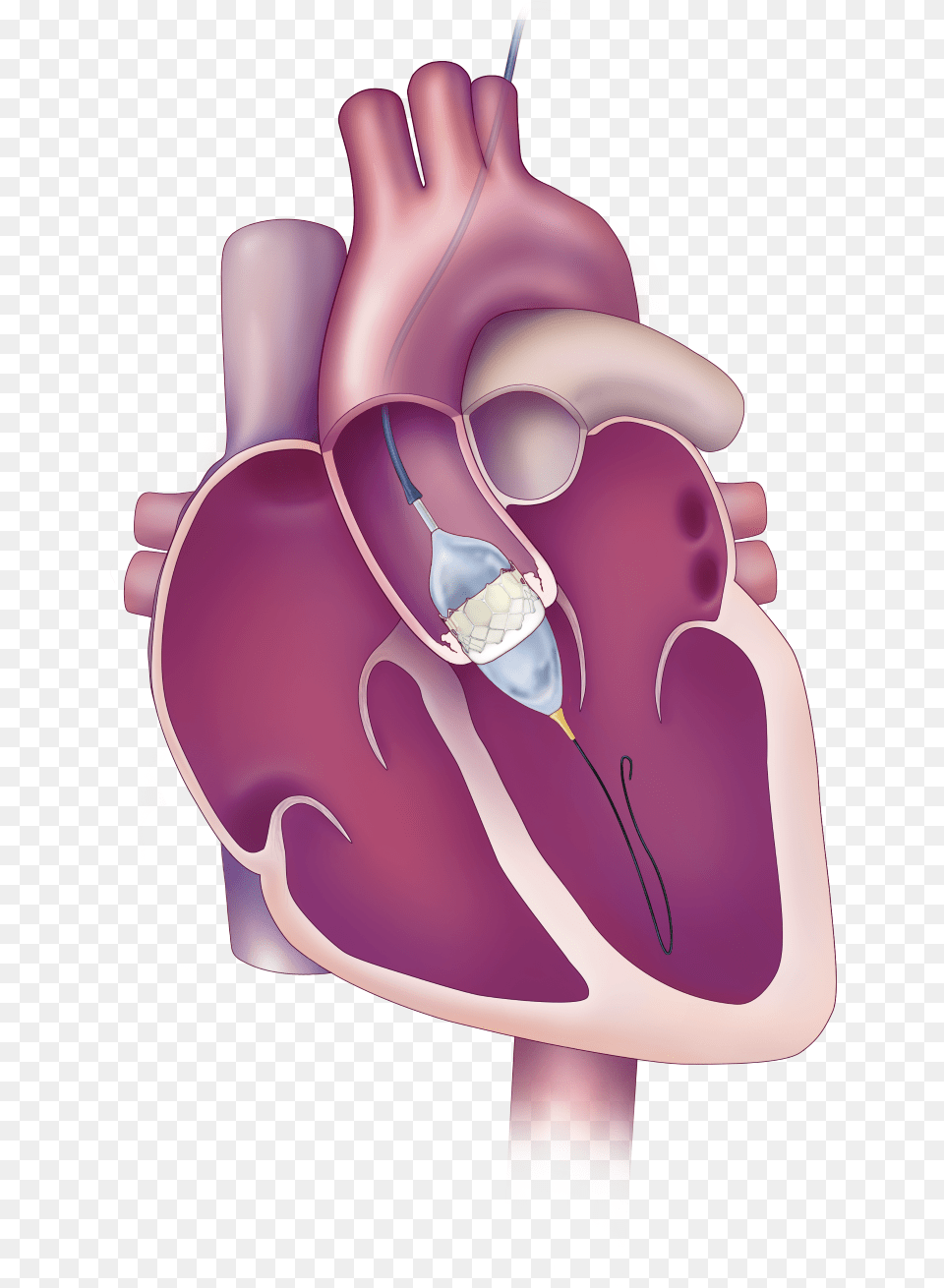 Aortic Valve, Heart, Body Part, Hand, Person Png