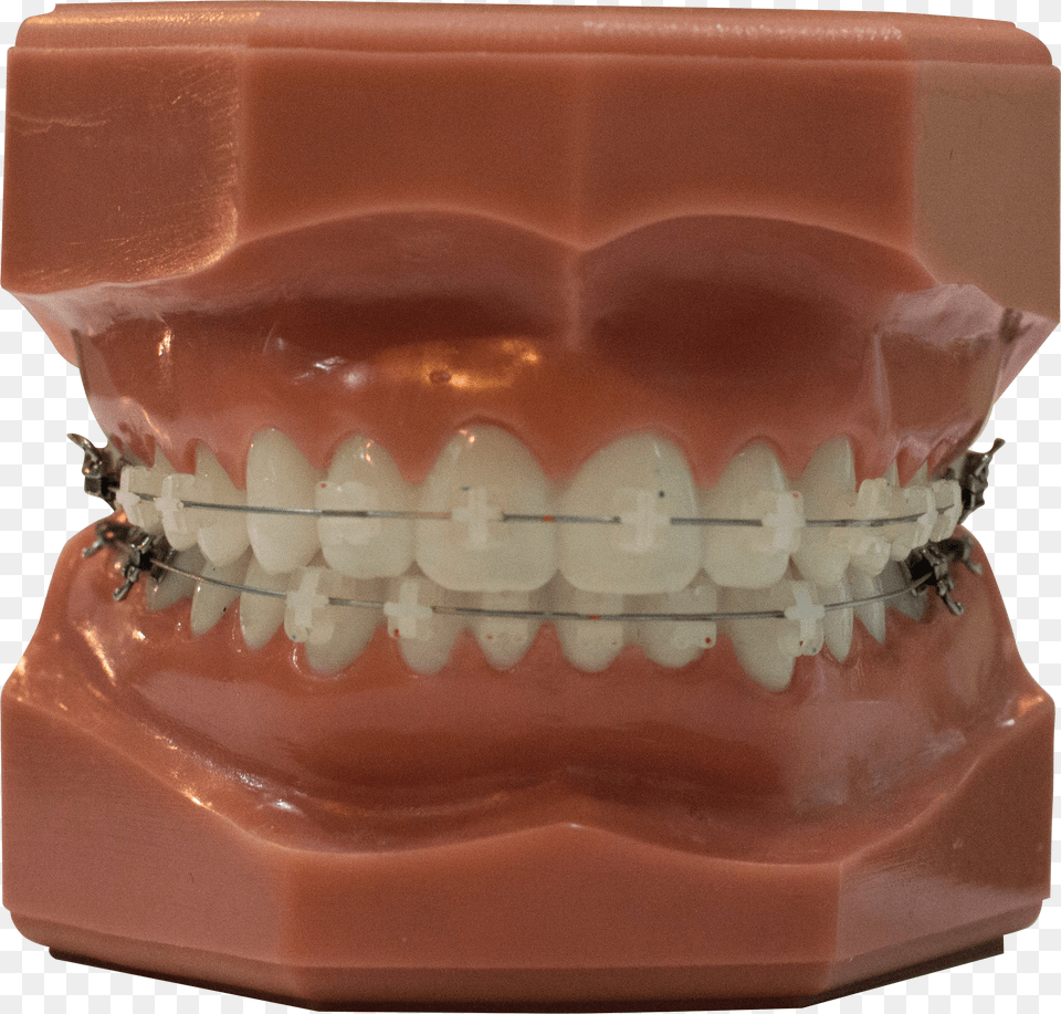 Apparecchio In Ceramica Ingiallisce Png Image