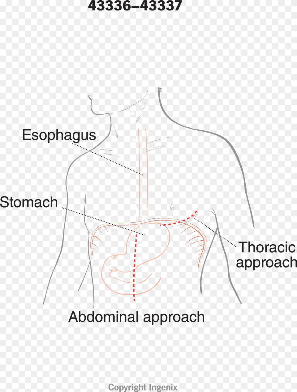 Approach Diagram, Chart, Plot, Adult, Male Png