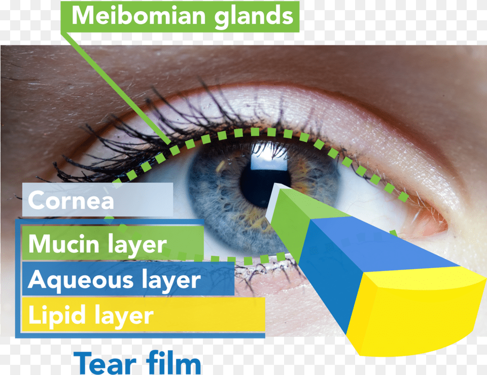 Aqueous Human Eye Many Pictures Aqueous Human, Contact Lens, Person Free Png Download
