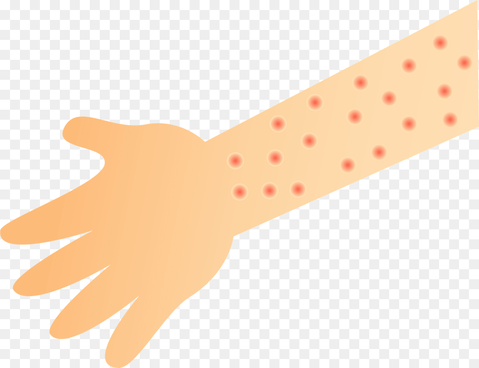Arm With Skin Rash Clipart, Wrist, Body Part, Person, Hand Free Transparent Png
