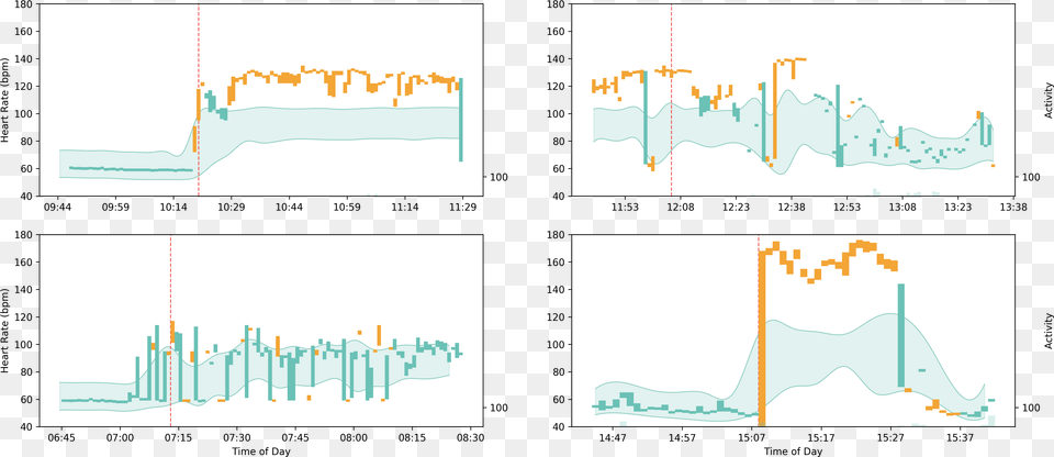 Arrhythmia Activity Bars Heart Arrhythmia, Chart, Plot, Text Free Png