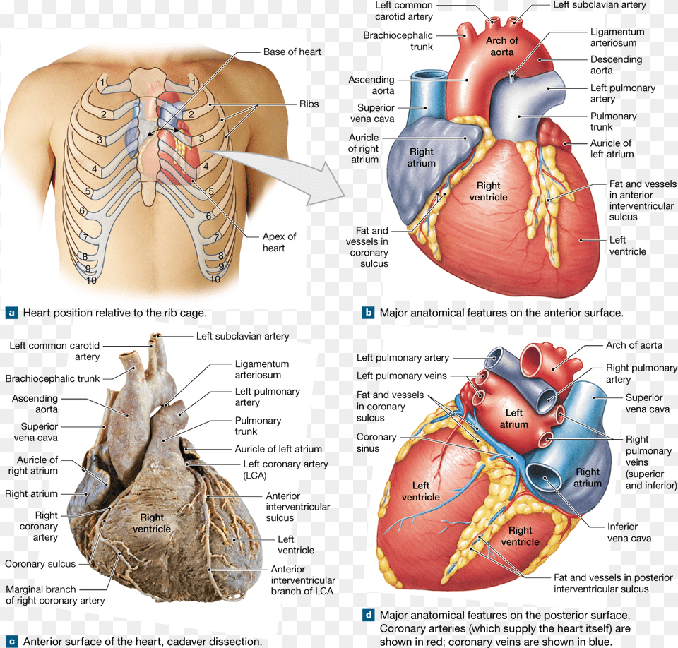 Arteries Of The Heart Cadaver, Body Part, Person, Skin, Torso Free Png Download