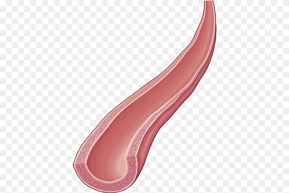 Arteries Plywood, Food, Meat, Pork, Smoke Pipe Free Transparent Png