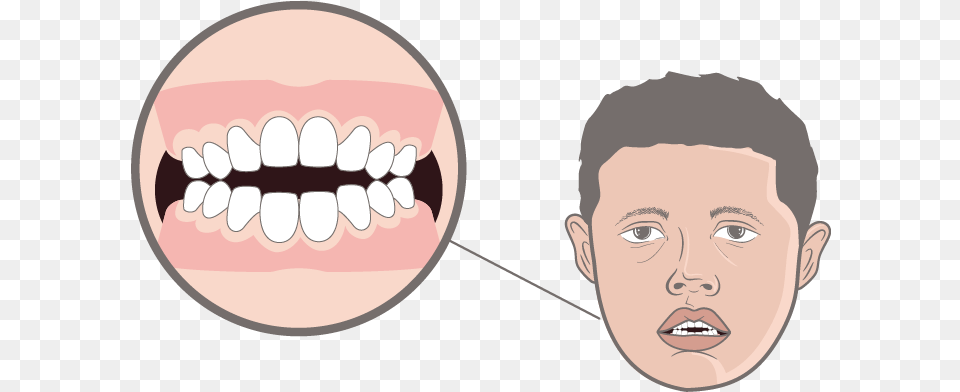 Asset 19 Asset, Teeth, Person, Mouth, Head Png Image