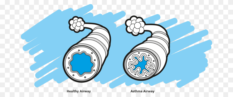 Asthma Clip Art, Machine, Spoke, Coil, Spiral Png Image