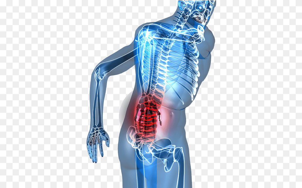 At Luke Chiropractic Amp Sports Injury We Offer Chiropractic Low Back Pain, Adult, Female, Person, Woman Free Png Download