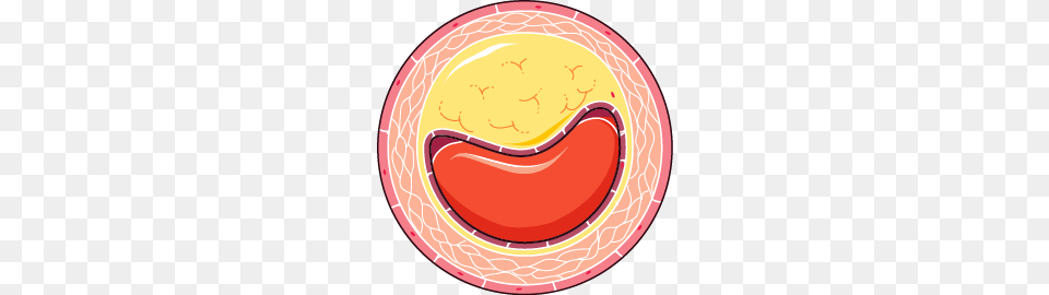 Atheroma, Plate, Food Free Transparent Png