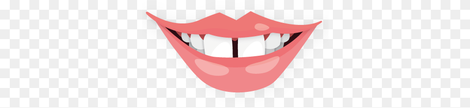 Aumento De Labios Orthodontics, Body Part, Mouth, Person, Teeth Png