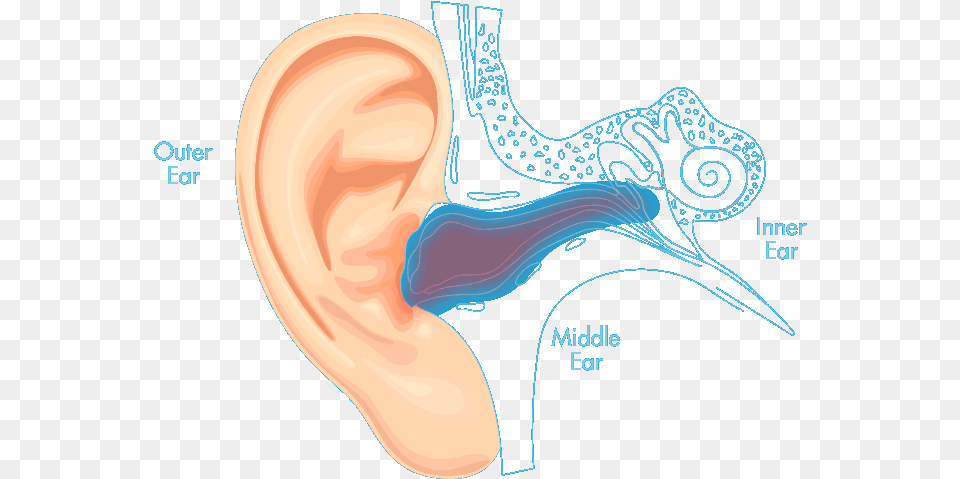 Auro Ear Drops Water In Your Ear, Body Part, Adult, Female, Person Free Png Download