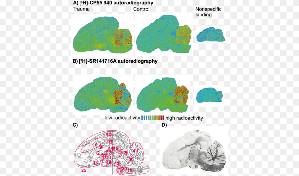 Autoradiographs Of Adjacent Slices Of The Piglet Brain Diagram, Art, Collage, Land, Nature Free Png Download