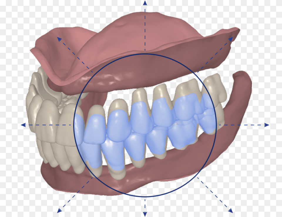 Avadent Digital Dental Solutions Has Always Provided, Body Part, Mouth, Person, Teeth Png