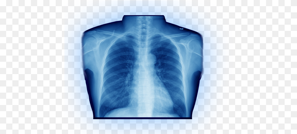 Avoid The Hospital Hassleaffordable X Rays In As Little Download, Ct Scan, X-ray, Adult, Bride Png