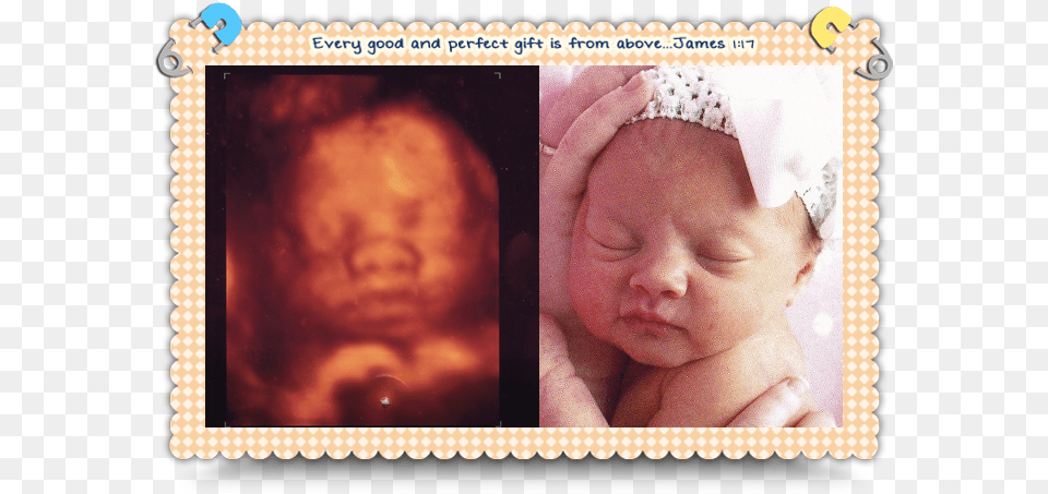 Baby Piper Baby Face 4d Ultrasound, Newborn, Person, Head, Photography Free Png Download