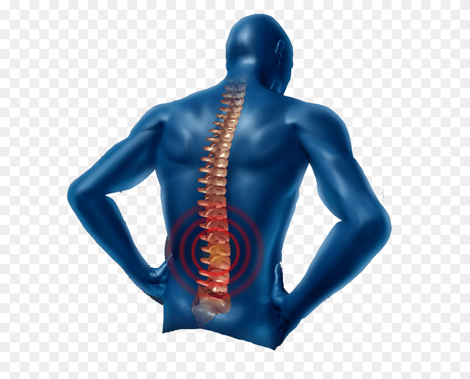 Back Pain Human Dummy Florida Pain Management Pain, Body Part, Person, Torso, Adult Png