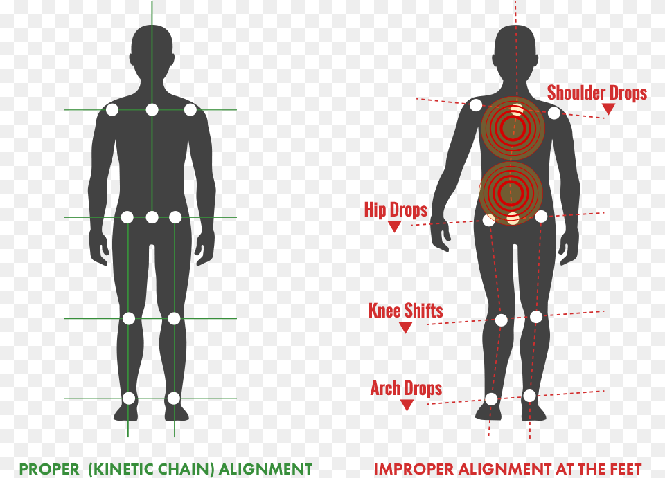 Back Pain Illustration, Chart, Measurements, Plot, Adult Png