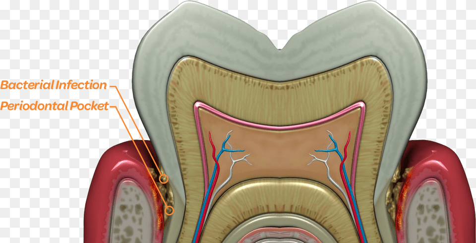Bacteria Thrive Deep Below The Gum Line In The Periodontal Tooth, Cushion, Home Decor, Furniture, Chair Free Png Download