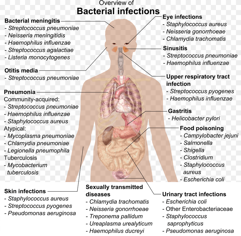 Bacterial Infections And Involved Species Overview Of Bacterial Infections, Adult, Male, Man, Person Free Png