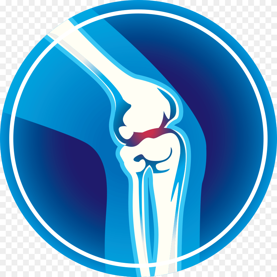 Banner Arthritis Monroe Clinic Did You Joint Pain Clip Art, Ct Scan, Disk, X-ray Free Png Download
